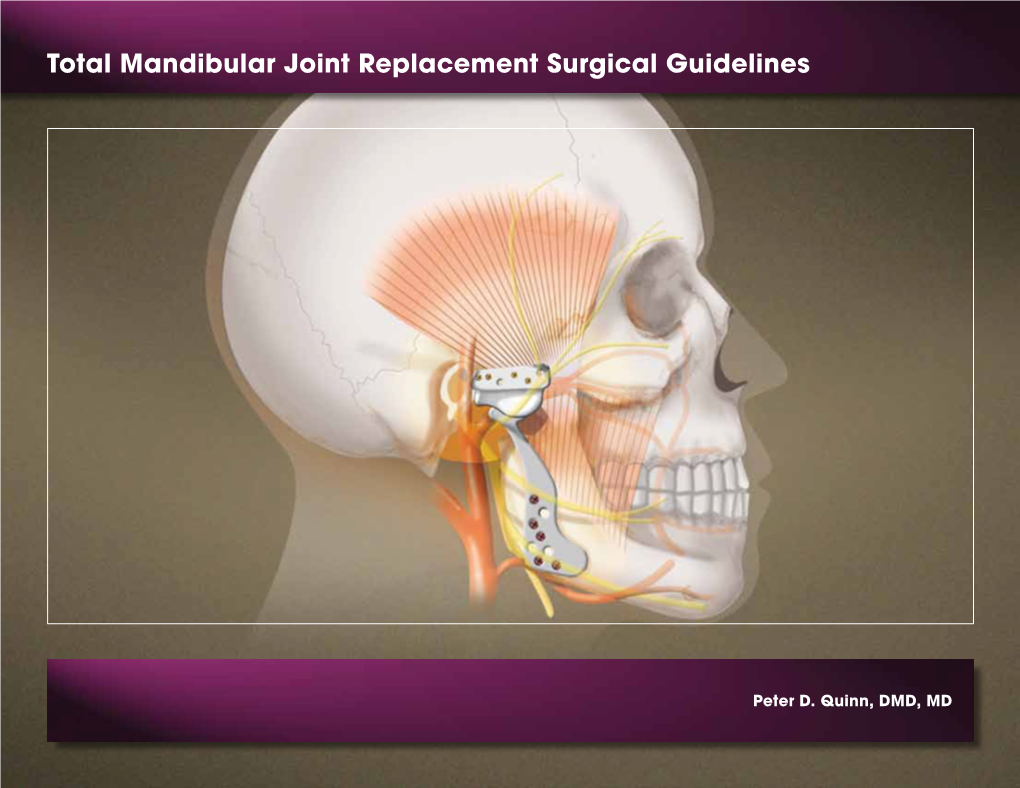 Total Mandibular Joint Replacement Surgical Guidelines