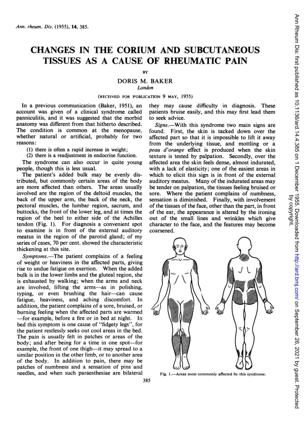 Changes in the Corium and Subcutaneous Tissues As a Cause of Rheumatic Pain by Doris M