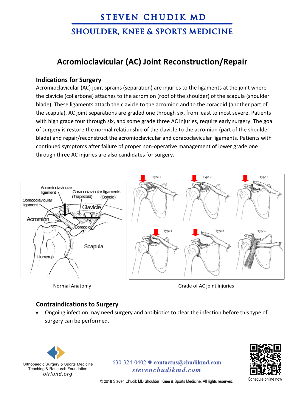 Acromioclavicular Ac Joint Separation Repair And Reconstruction By Dr