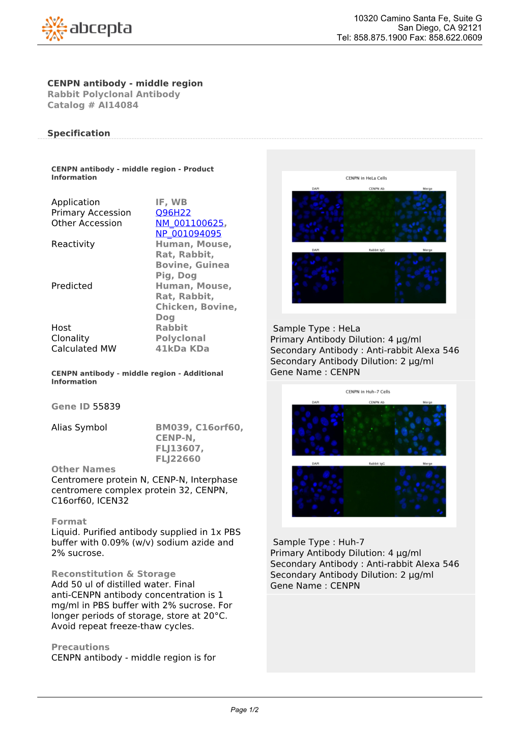 CENPN Antibody - Middle Region Rabbit Polyclonal Antibody Catalog # AI14084