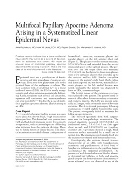 Multifocal Papillary Apocrine Adenoma Arising in a Systematized Linear Epidermal Nevus
