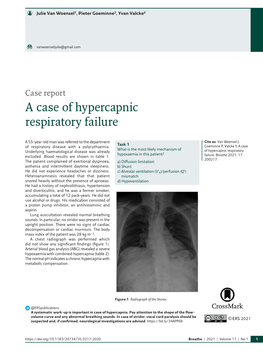 A Case of Hypercapnic Respiratory Failure