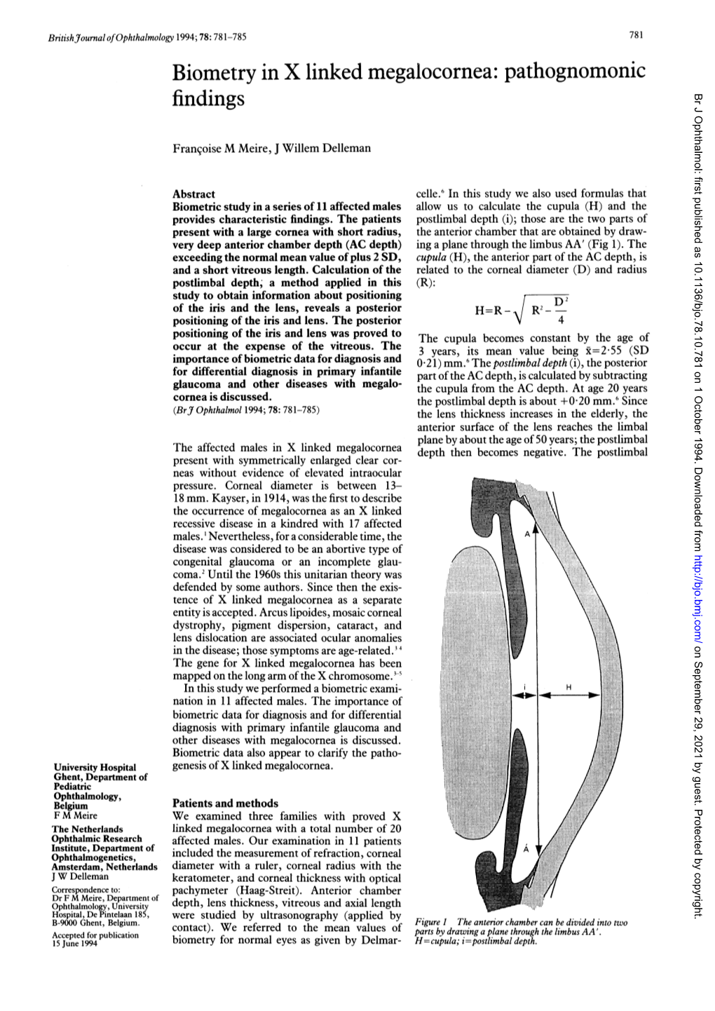 Biometry in X Linked Megalocornea: Pathognomonic Findings Br J Ophthalmol: First Published As 10.1136/Bjo.78.10.781 on 1 October 1994