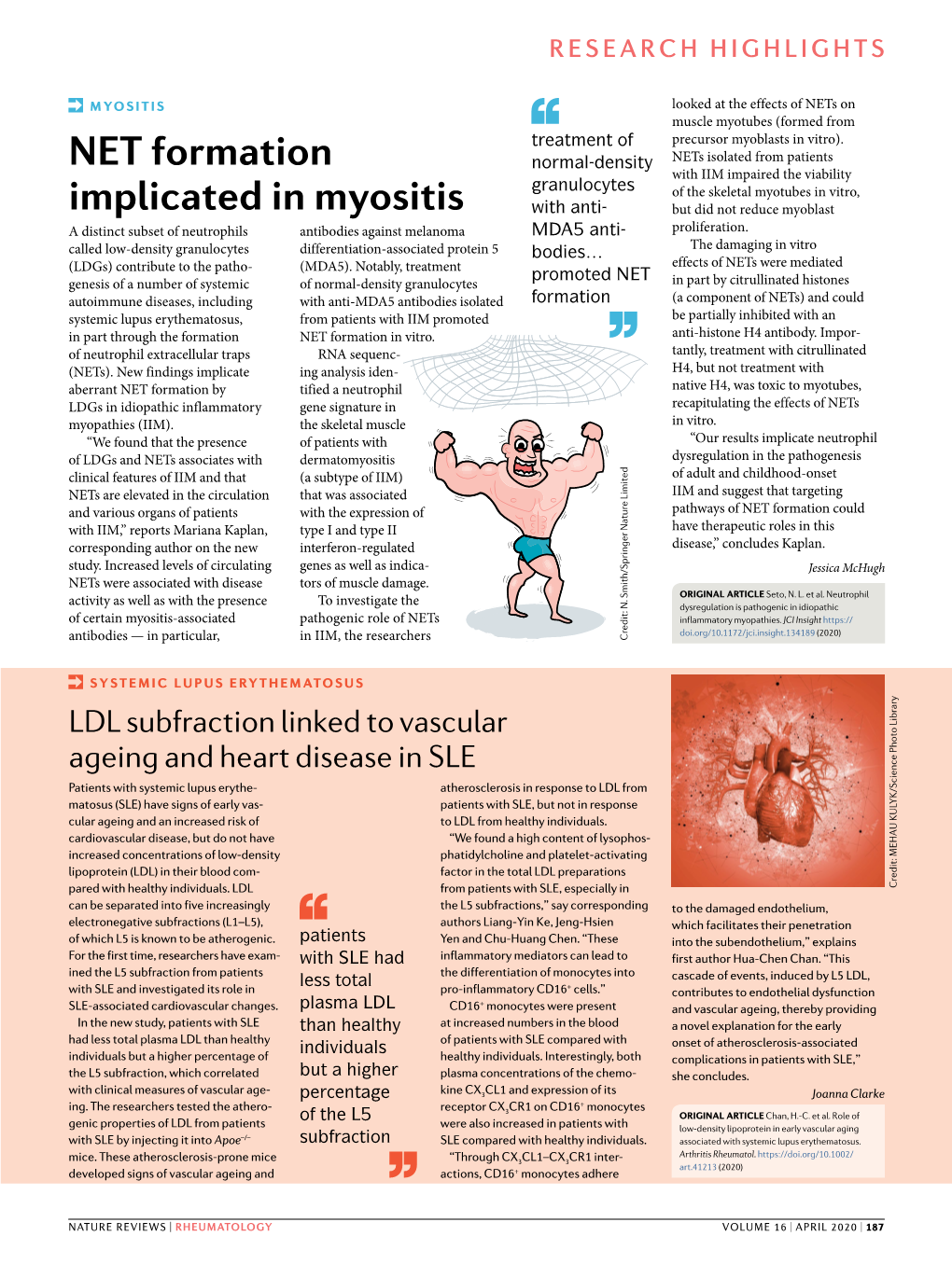 NET Formation Implicated in Myositis