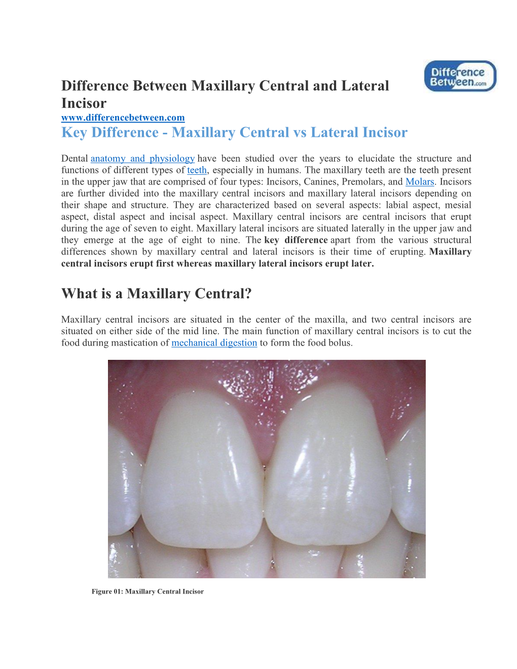 Difference Between Maxillary Central and Lateral Incisor?