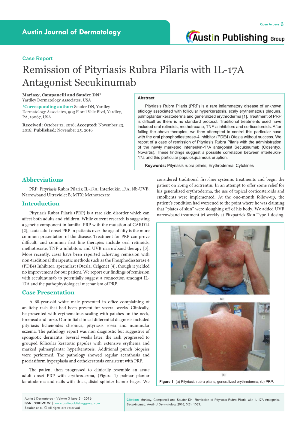 Remission of Pityriasis Rubra Pilaris with IL-17A Antagonist Secukinumab