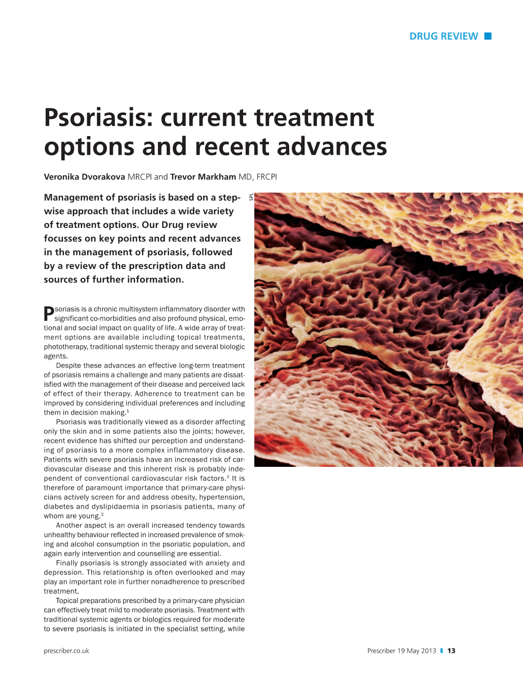 Psoriasis: Current Treatment Options and Recent Advances