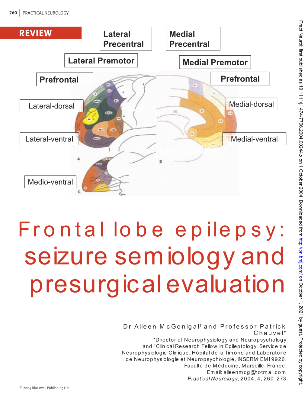 Seizure Semiology and Presurgical Evaluation on October 1, 2021 by Guest