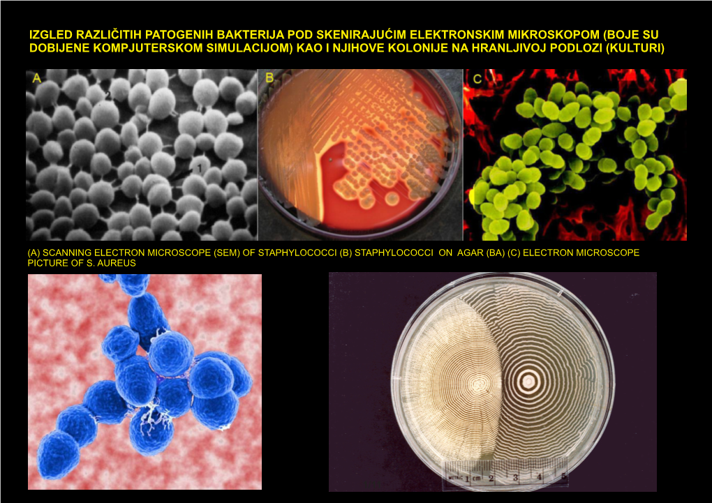 Izgled Različitih Patogenih Bakterija Pod Skenirajućim Elektronskim Mikroskopom (Boje Su Dobijene Kompjuterskom Simulacijom) K