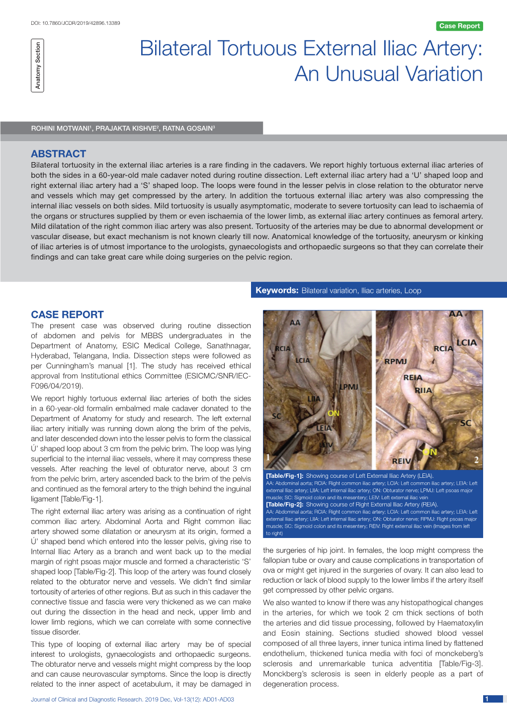 Bilateral Tortuous External Iliac Artery: an Unusual Variation Anatomy Section