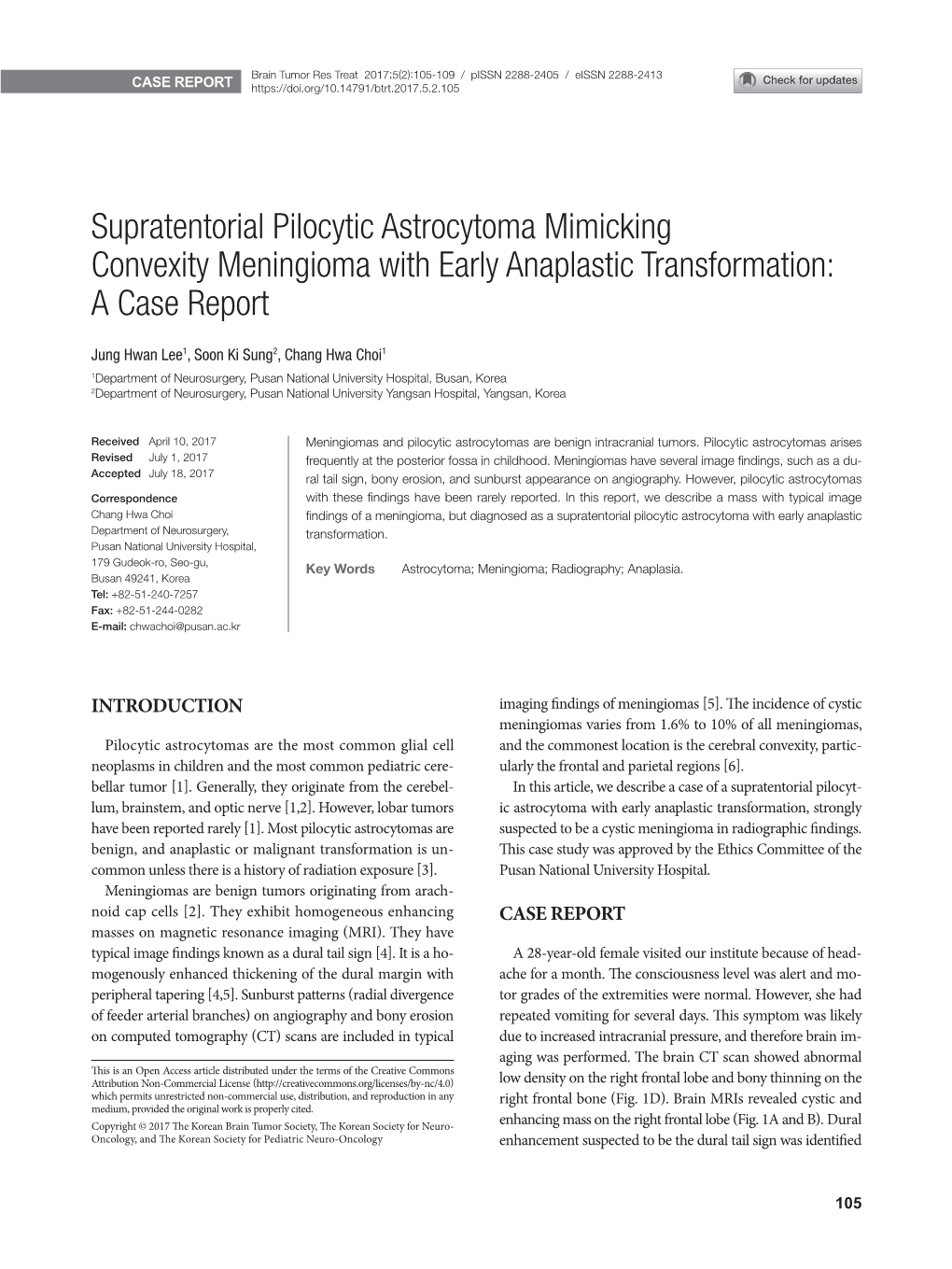 Supratentorial Pilocytic Astrocytoma Mimicking Convexity Meningioma with Early Anaplastic Transformation: a Case Report