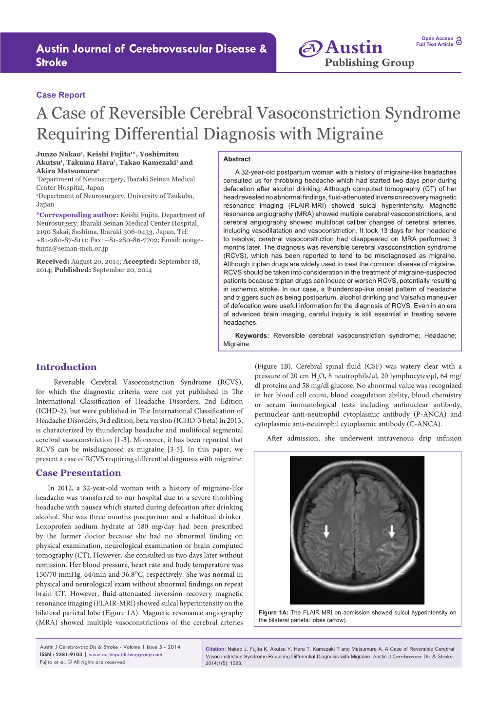 A Case of Reversible Cerebral Vasoconstriction Syndrome Requiring Differential Diagnosis with Migraine