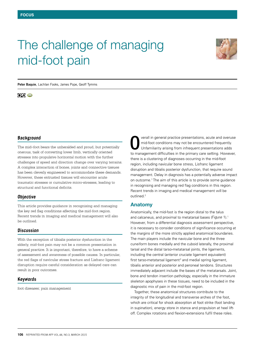 The Challenge of Managing Mid-Foot Pain