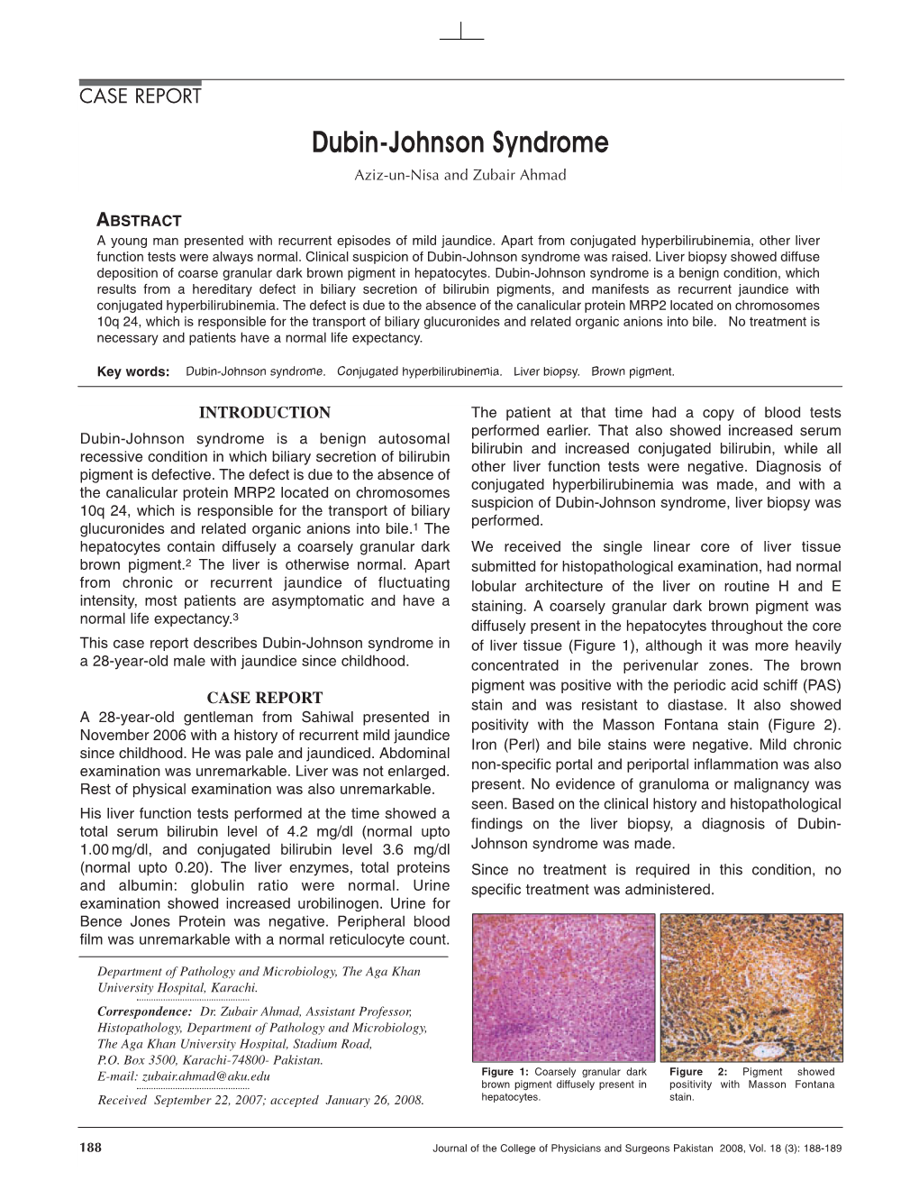 Dubin-Johnson Syndrome Aziz-Un-Nisa and Zubair Ahmad
