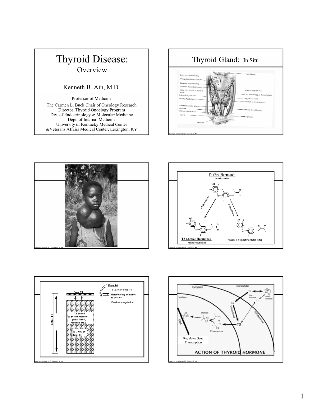 Thyroid Disease: Thyroid Gland: in Situ Overview