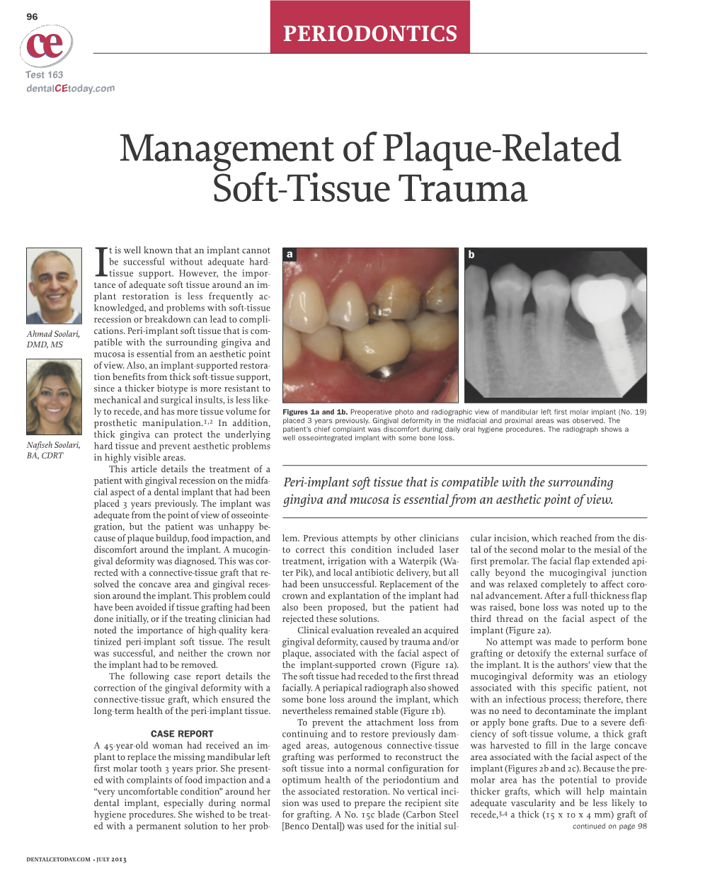 Management of Plaque-Related Soft-Tissue Trauma