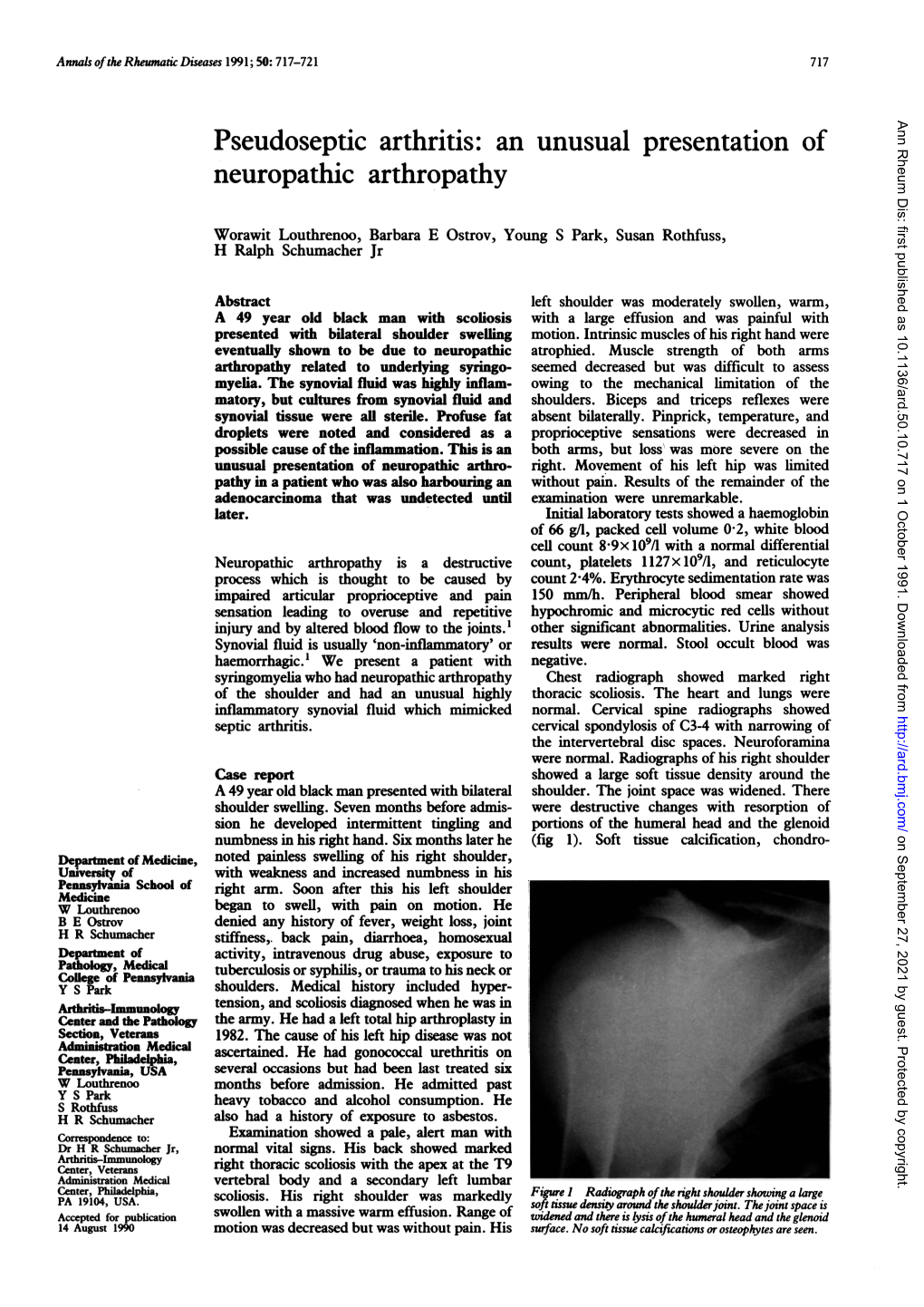 An Unusual Presentation of Neuropathic Arthropathy