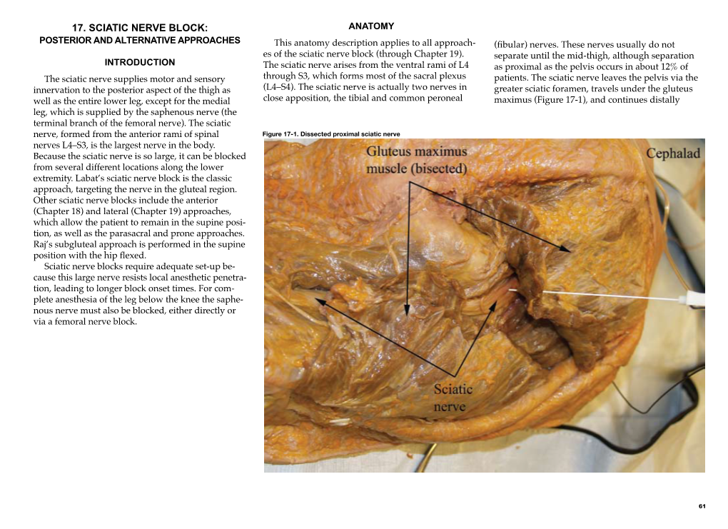 Sciatic Nerve Block: Posterior and Alternative Approaches