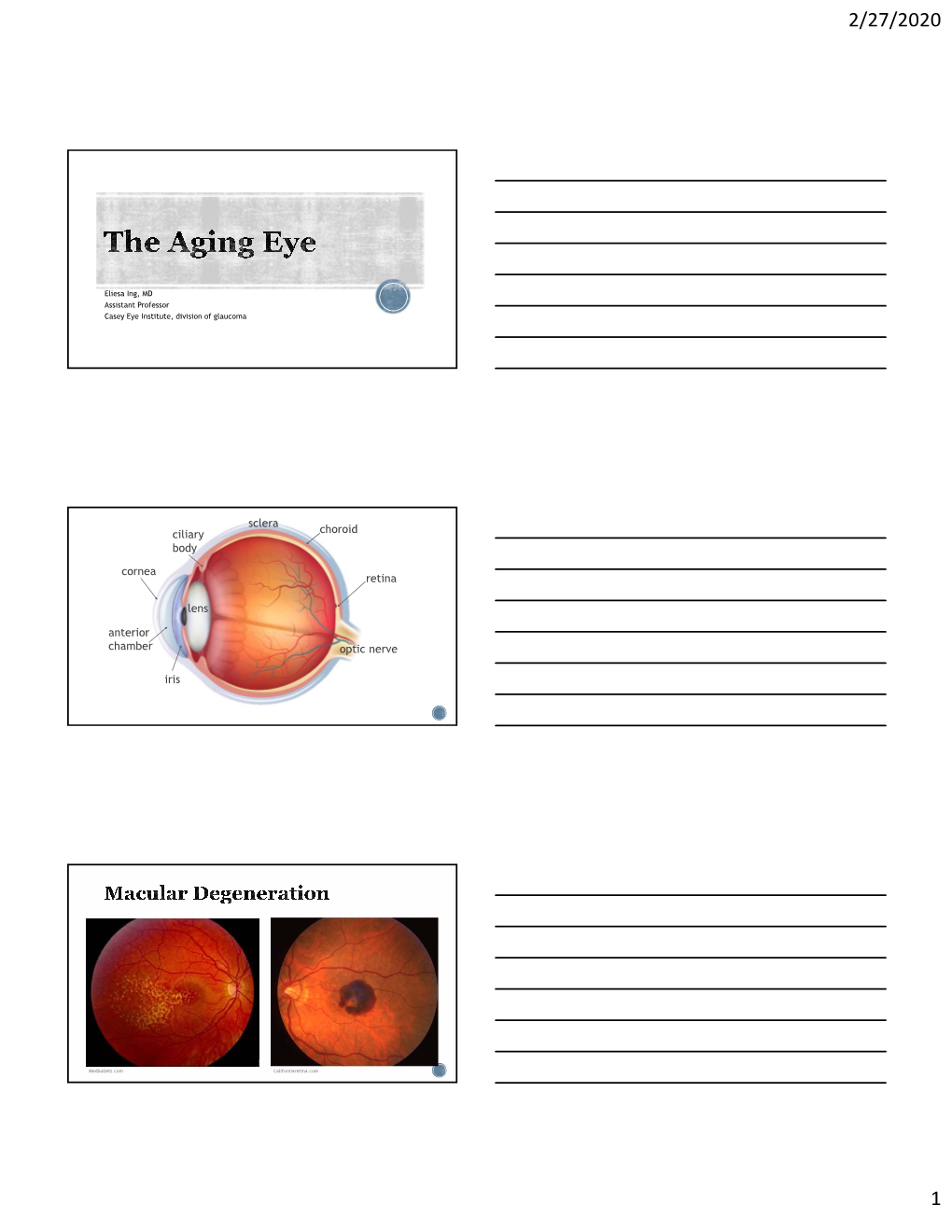 Choroid Sclera Optic Nerve Retina Lens Cornea Iris Anterior Chamber Ciliary