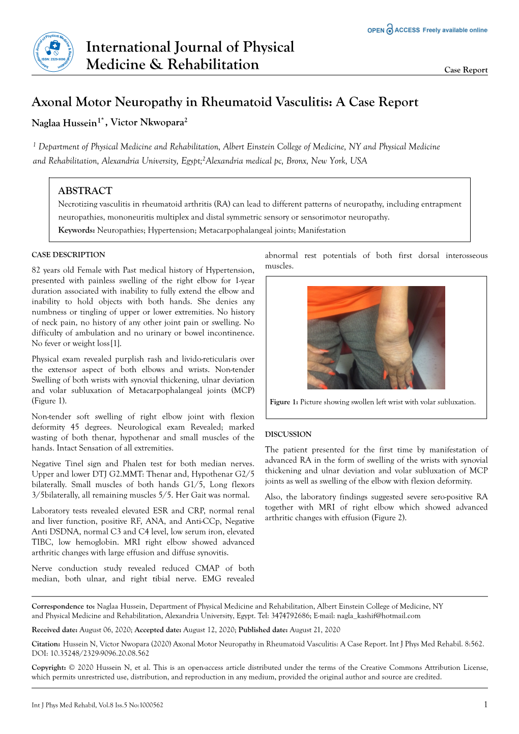 Axonal Motor Neuropathy in Rheumatoid Vasculitis: a Case Report Naglaa Hussein1* , Victor Nkwopara2