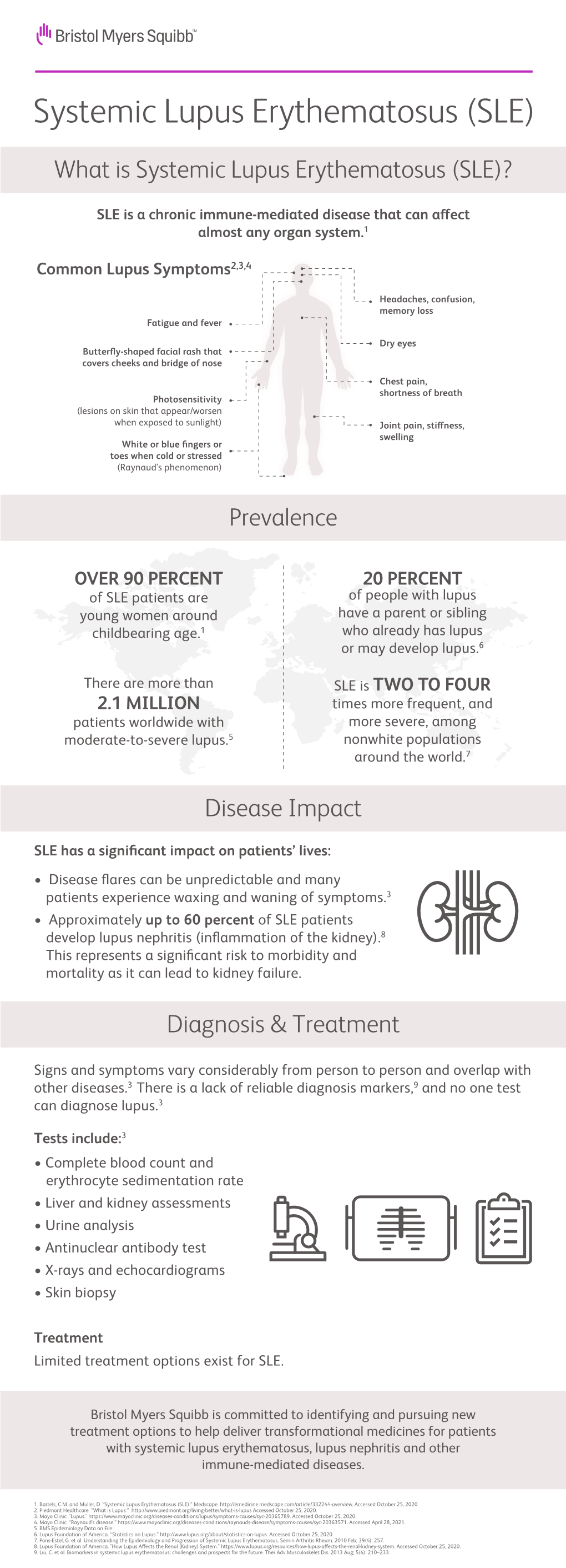 Systemic Lupus Erythematosus (SLE)