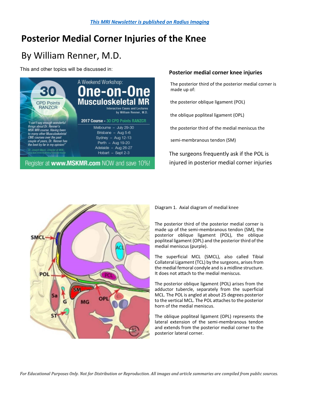 Posterior Medial Corner Injuries of the Knee by William Renner, M.D