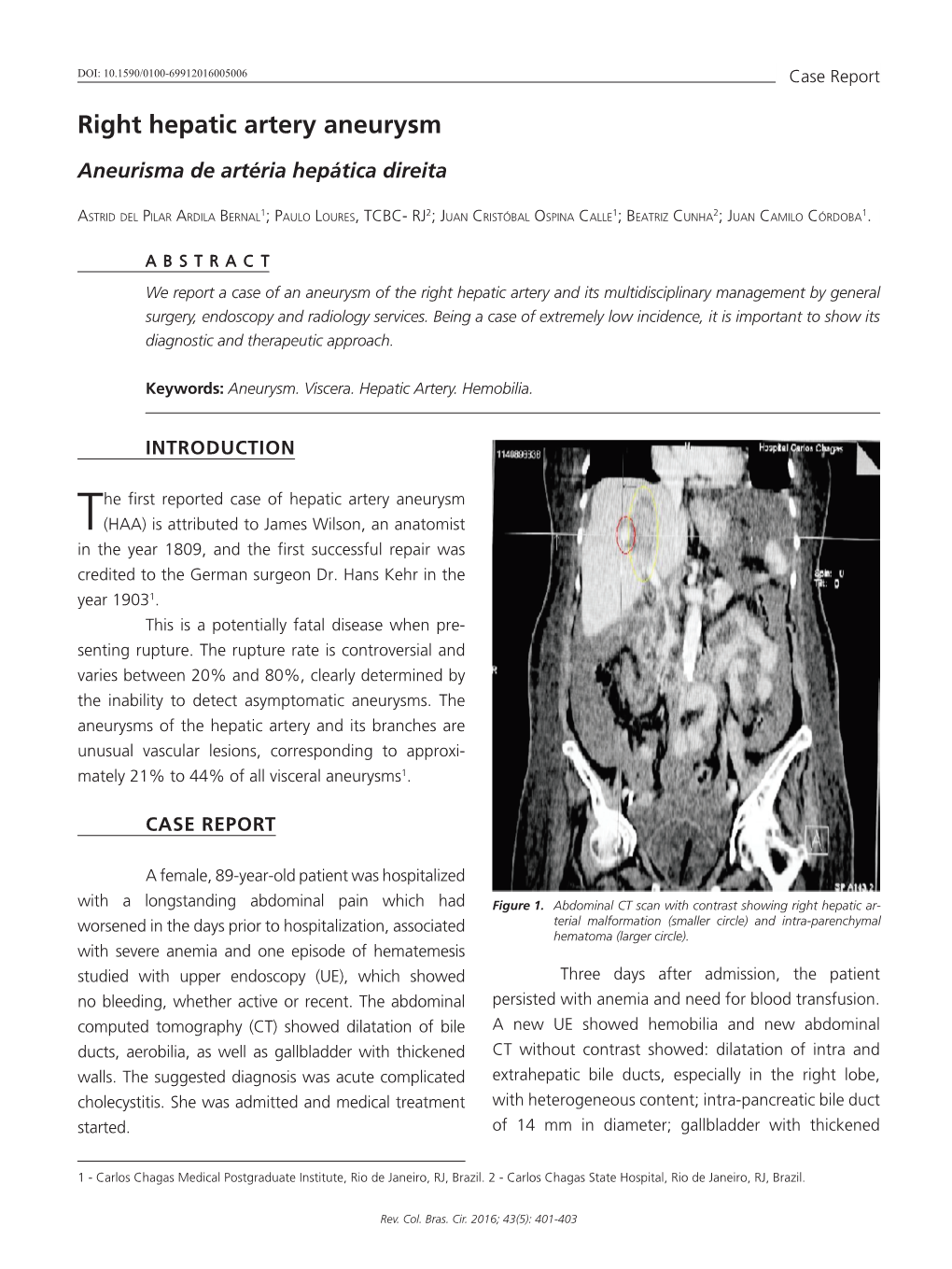 Right Hepatic Artery Aneurysm