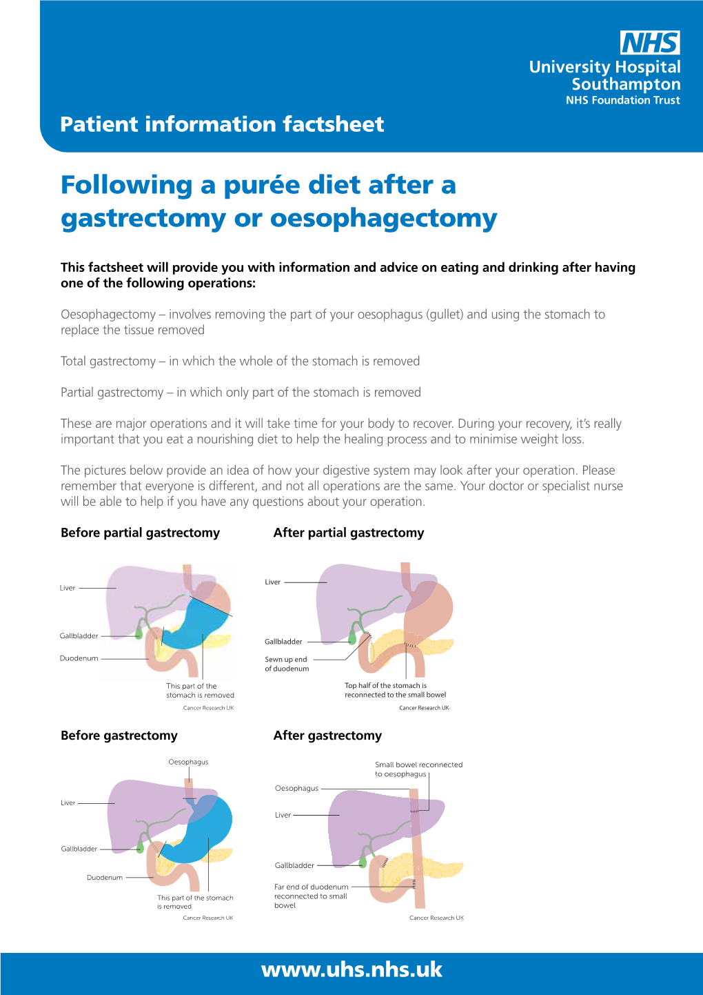 Following a Purée Diet After a Gastrectomy Or Oesophagectomy