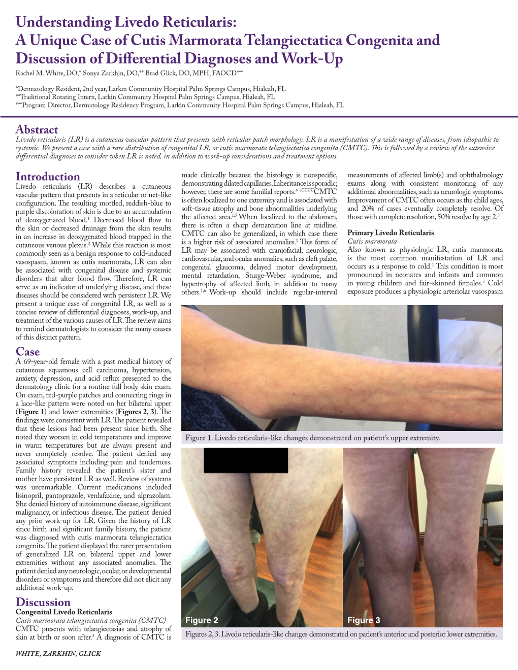 Understanding Livedo Reticularis: a Unique Case of Cutis Marmorata Telangiectatica Congenita and Discussion of Differential Diagnoses and Work-Up Rachel M