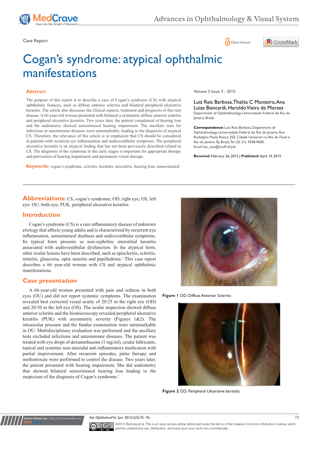 Cogan's Syndrome: Atypical Ophthalmic Manifestations