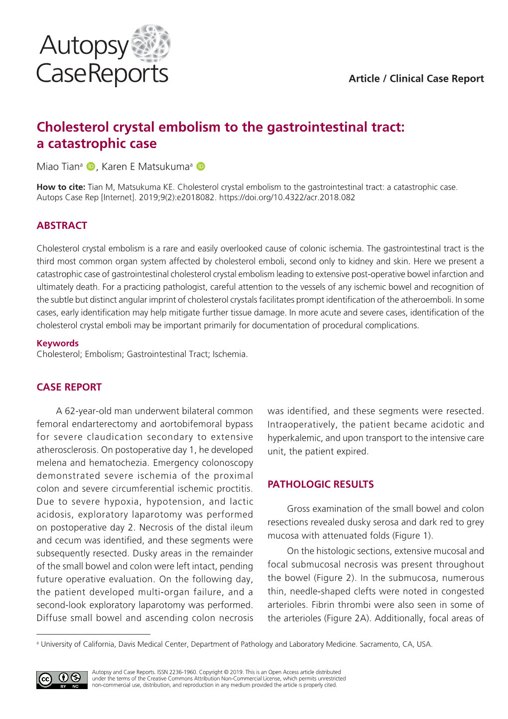 Cholesterol Crystal Embolism to the Gastrointestinal Tract: a Catastrophic Case