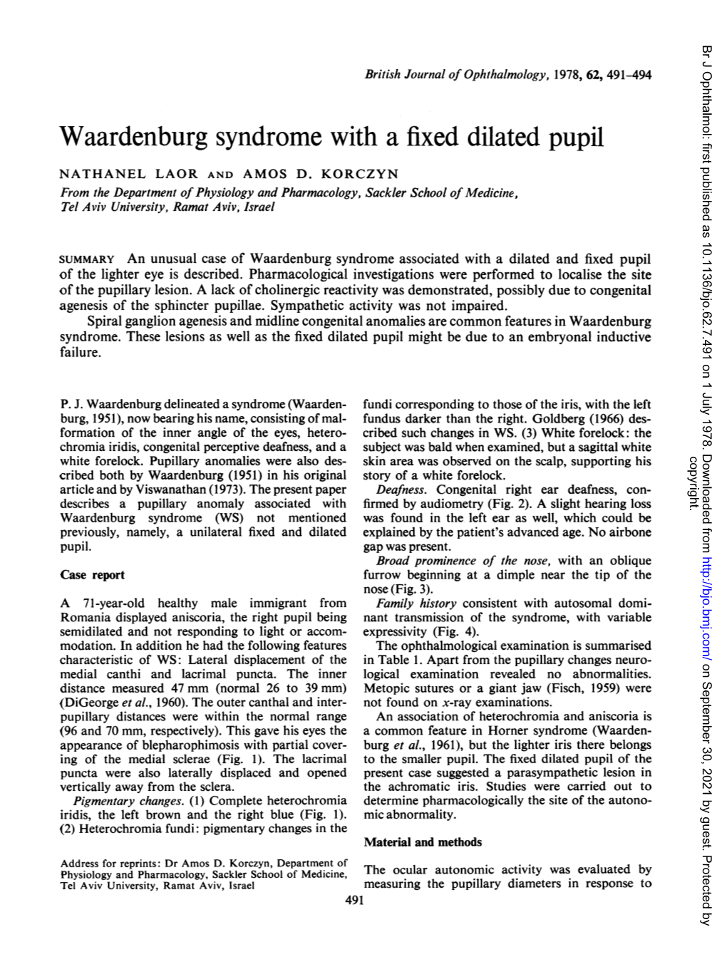 Waardenburg Syndrome with a Fixed Dilated Pupil
