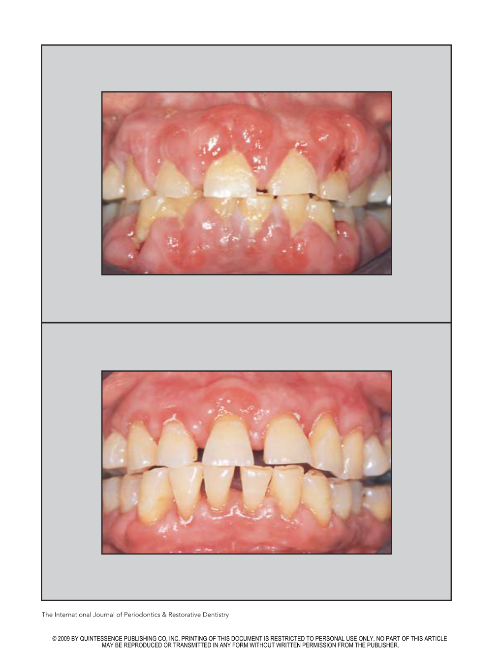 The International Journal of Periodontics & Restorative Dentistry