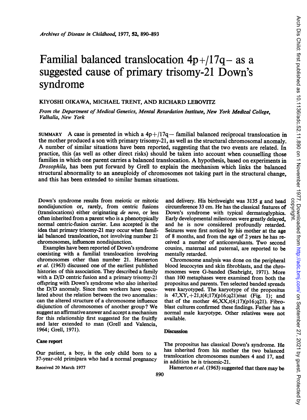 Familial Balanced Translocation 4P+/17Q- As a Suggested Cause of Primary Trisomy-21 Down's Syndrome