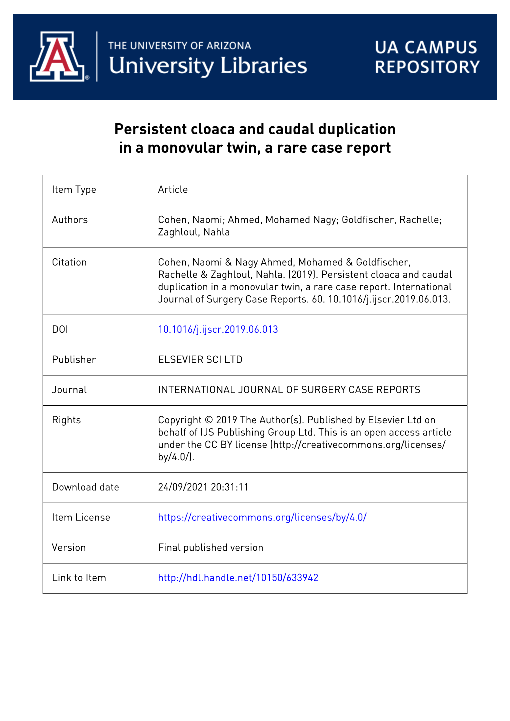 Persistent Cloaca and Caudal Duplication in a Monovular Twin, a Rare Case Report