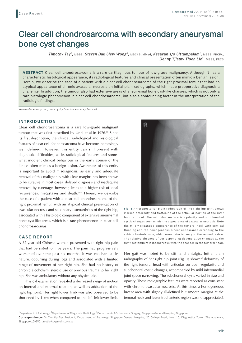 Clear Cell Chondrosarcoma with Secondary Aneurysmal Bone Cyst Changes