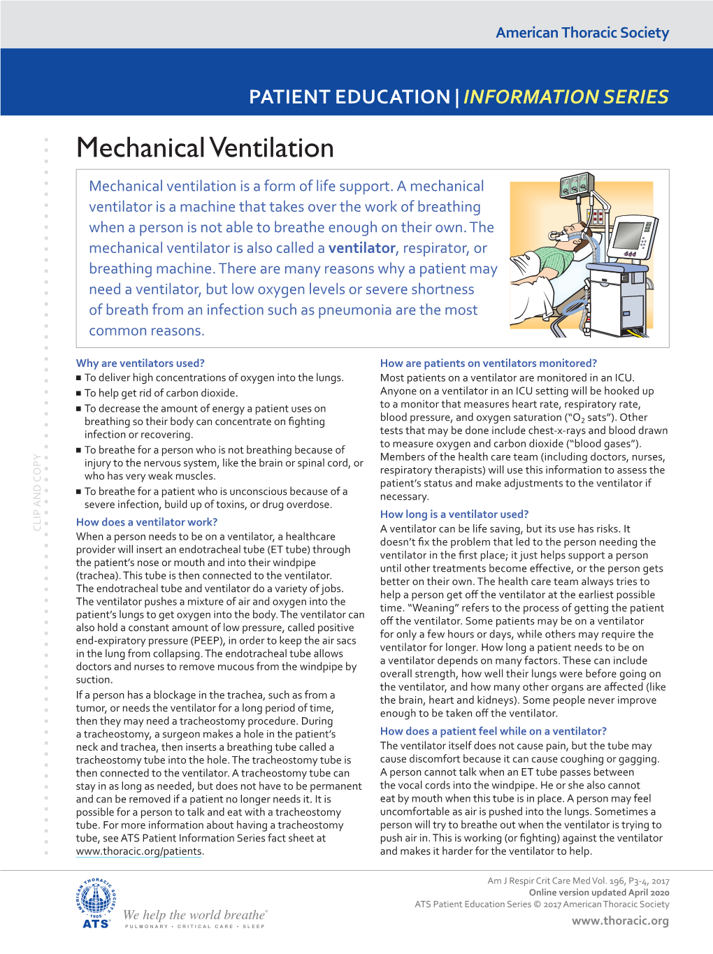 Mechanical Ventilation Mechanical Ventilation Is a Form of Life Support