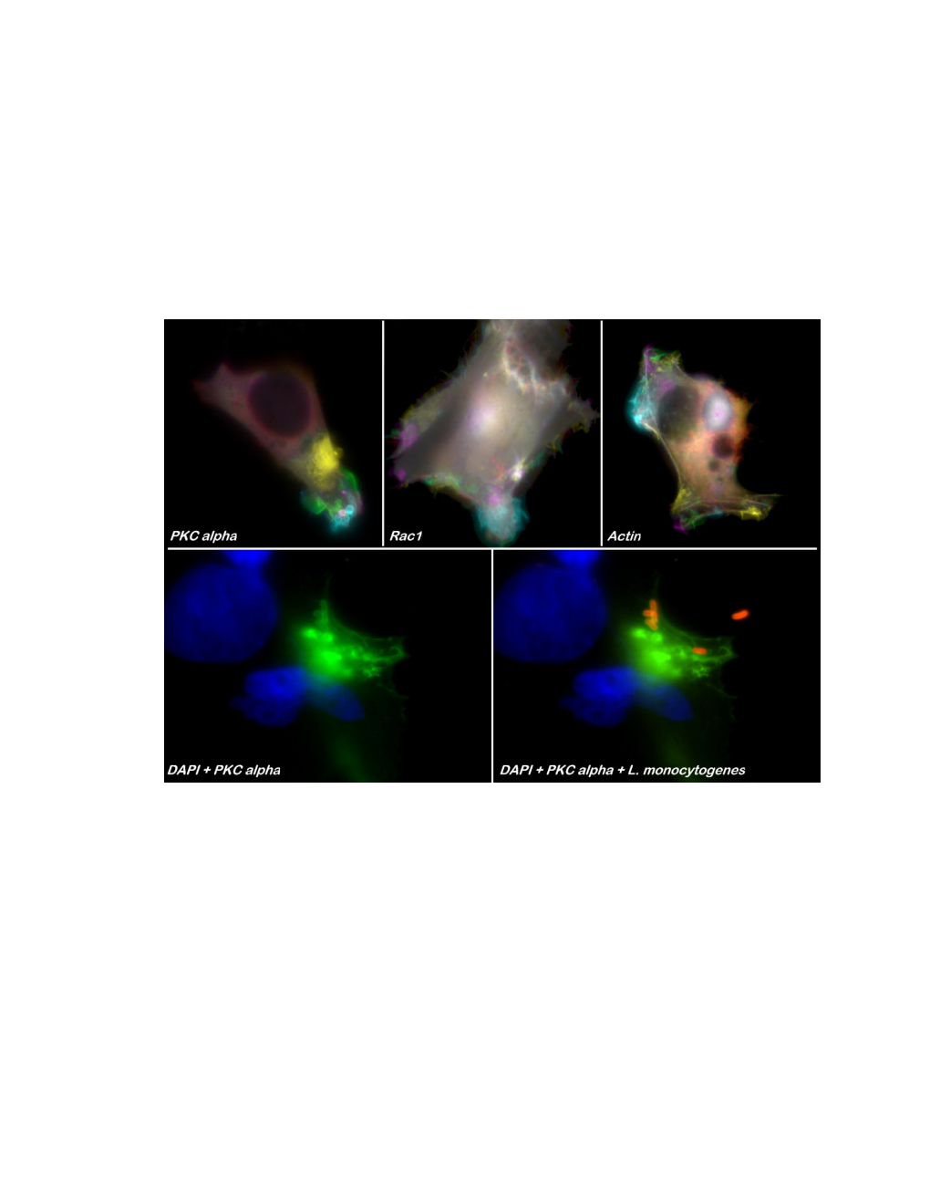 Identification of Mammalian Cell Signaling in Response to Plasma Membrane Perforation: Endocytosis of Listeria Monocytogenes and the Repair Machinery