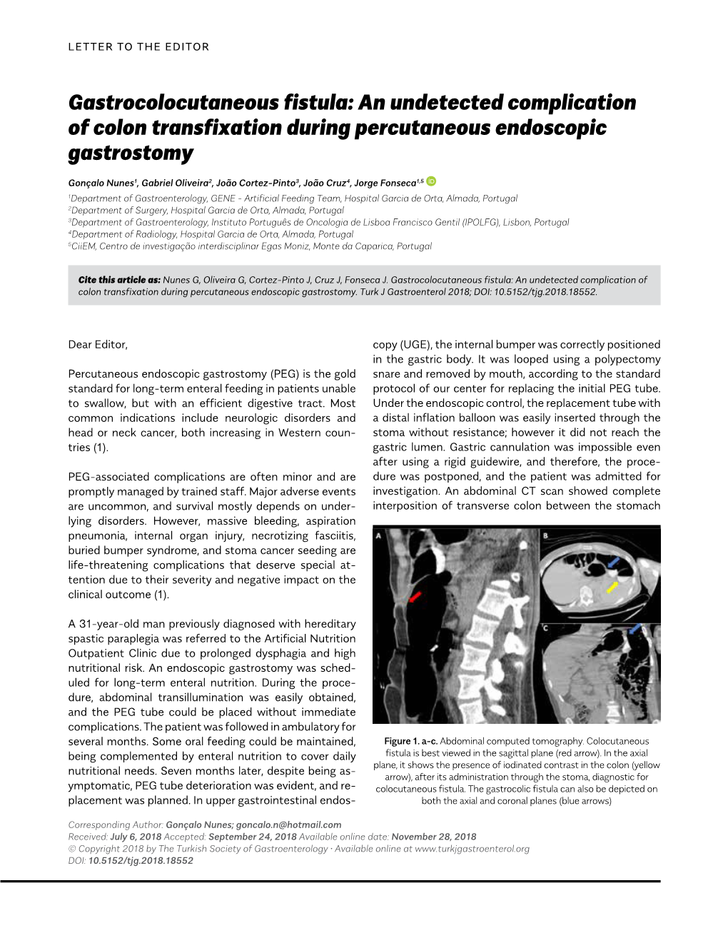Gastrocolocutaneous Fistula: an Undetected Complication of Colon Transfixation During Percutaneous Endoscopic Gastrostomy