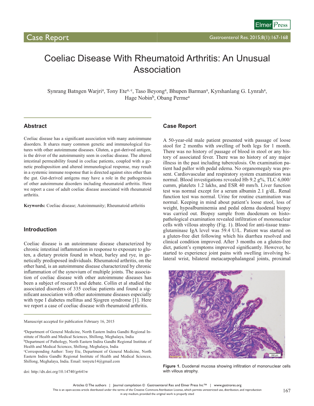 Coeliac Disease with Rheumatoid Arthritis: an Unusual Association