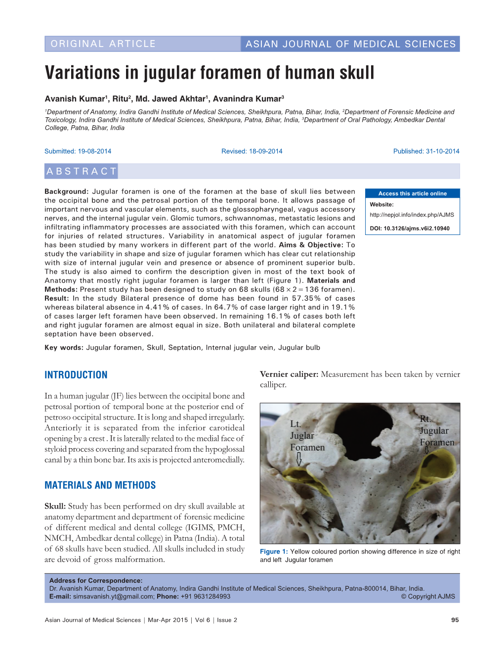 Variations in Jugular Foramen of Human Skull