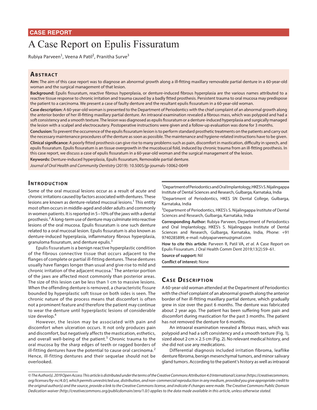 A Case Report on Epulis Fissuratum Rubiya Parveen1​, Veena a Patil2​, Pranitha Surve3​