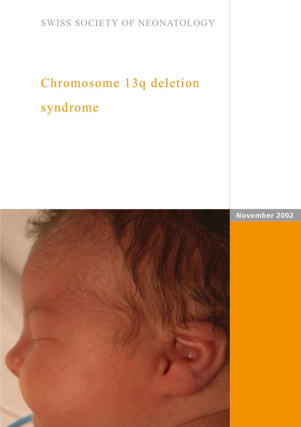 Chromosome 13Q Deletion Syndrome