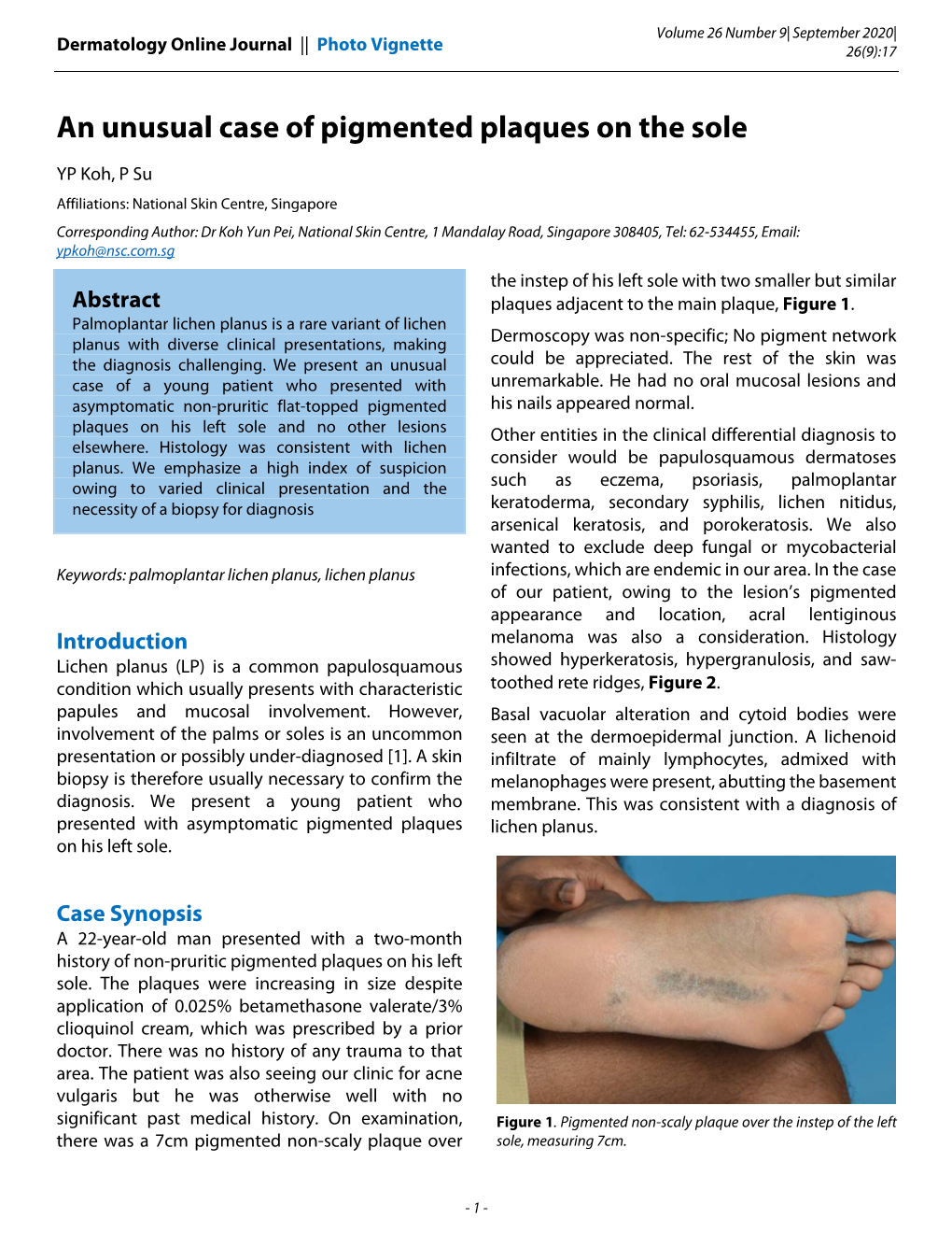 An Unusual Case of Pigmented Plaques on the Sole