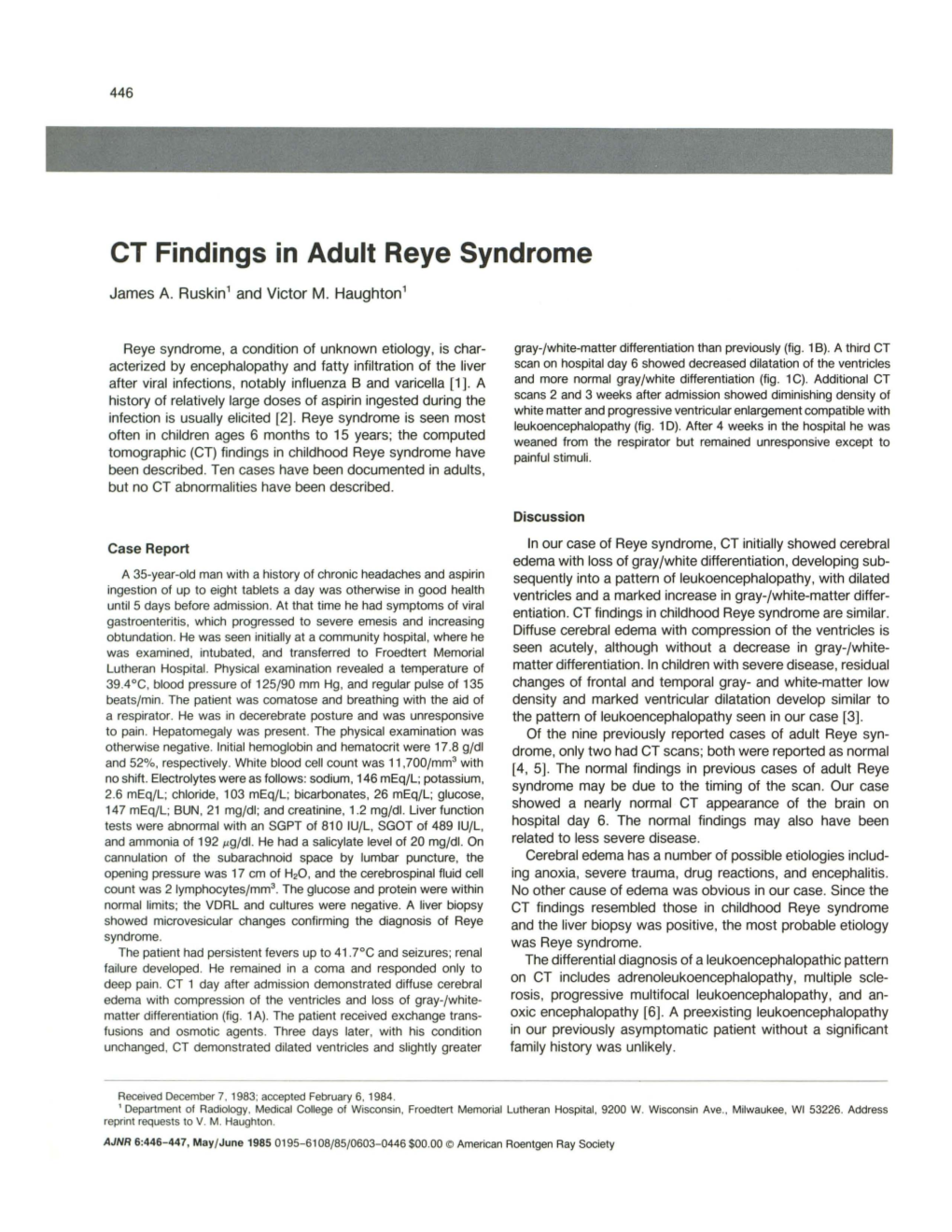 CT Findings in Adult Reye Syndrome