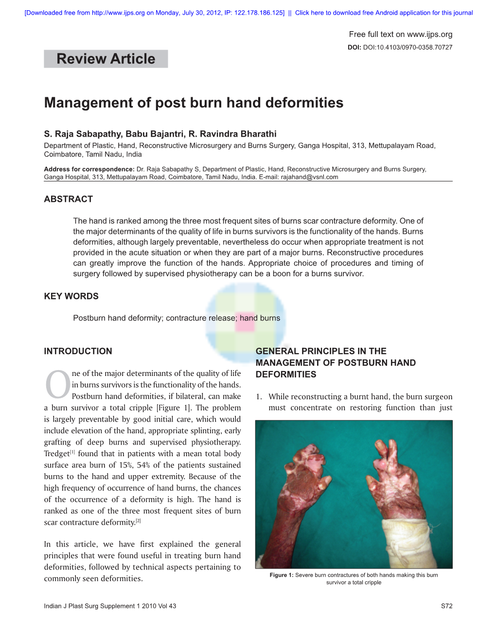 Management of Post Burn Hand Deformities Review Article