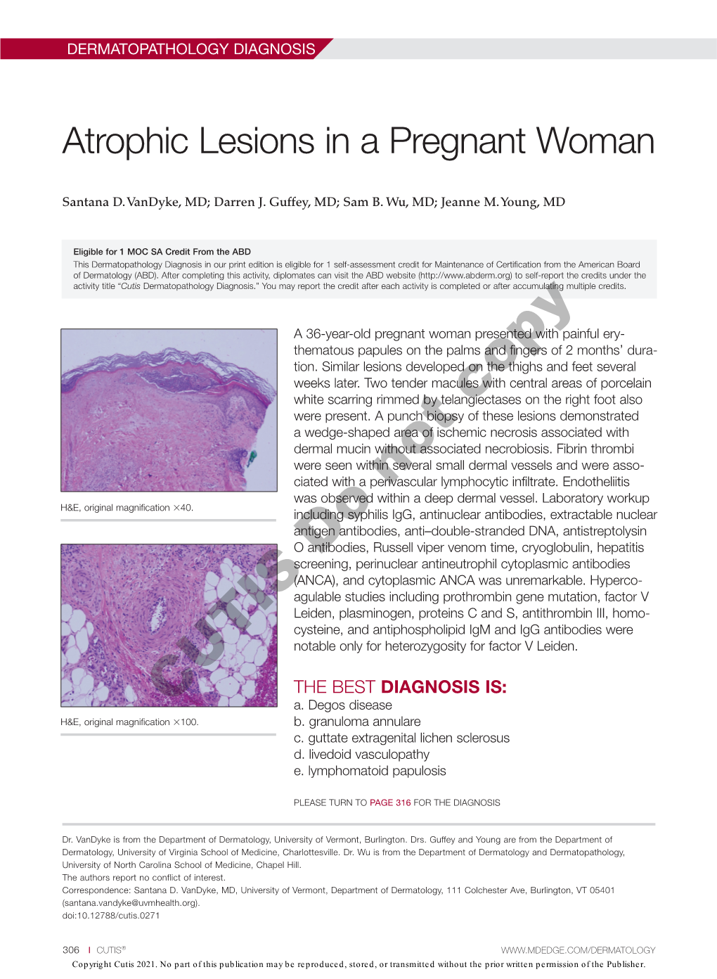 Atrophic Lesions in a Pregnant Woman