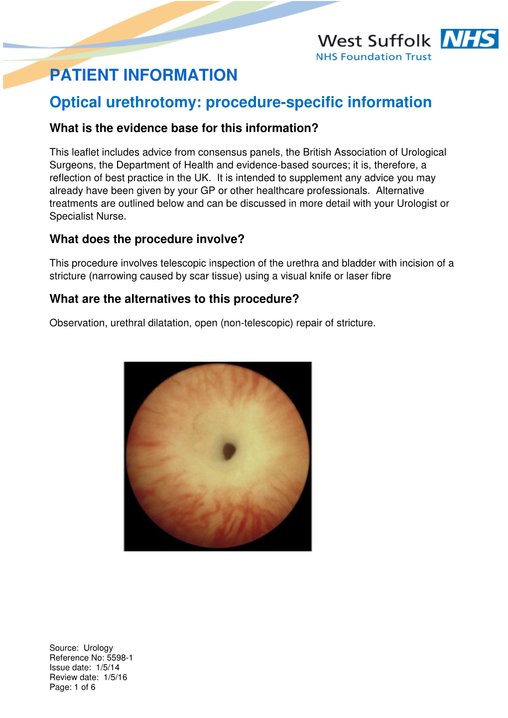 Optical Urethrotomy Procedure Specific Information