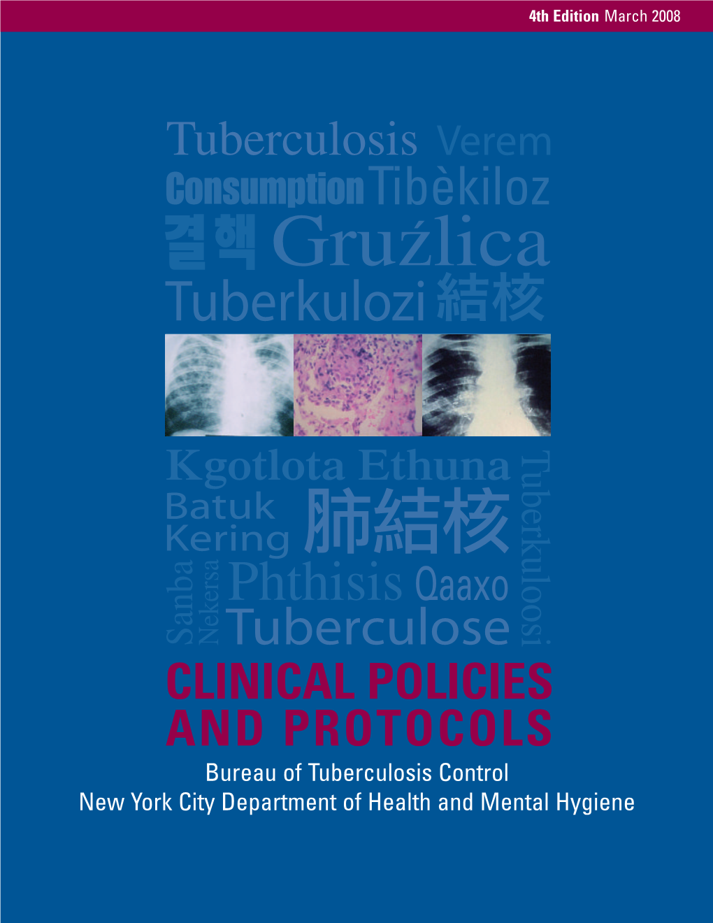 Tuberculosis (TB): Clinical Policies & Protocols