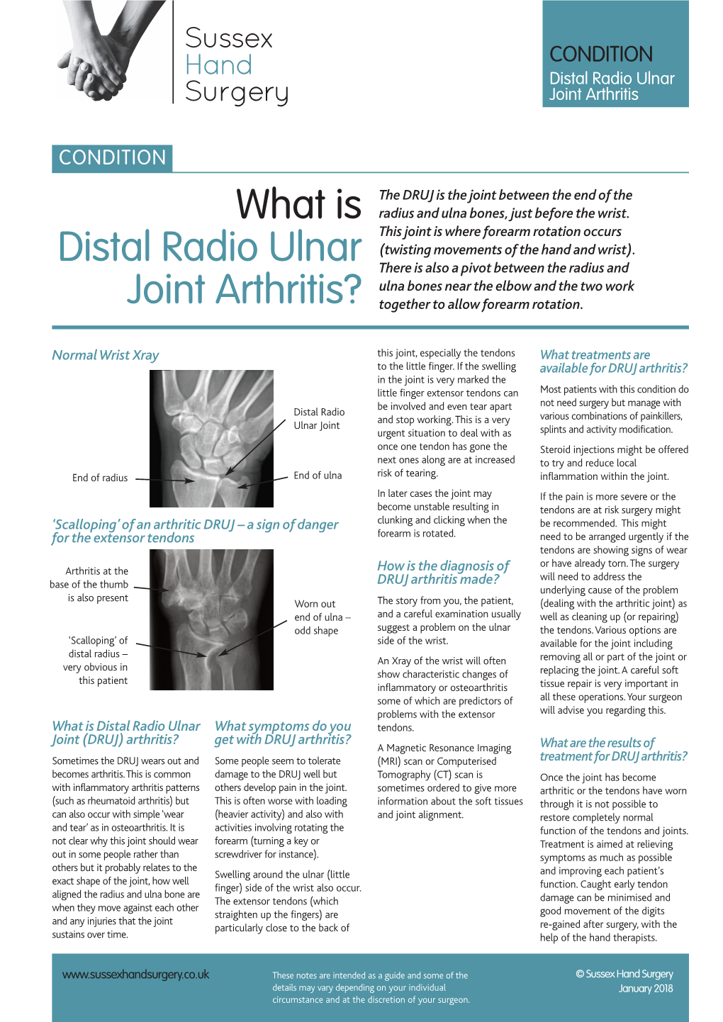 What Is Distal Radio Ulnar Joint Arthritis?